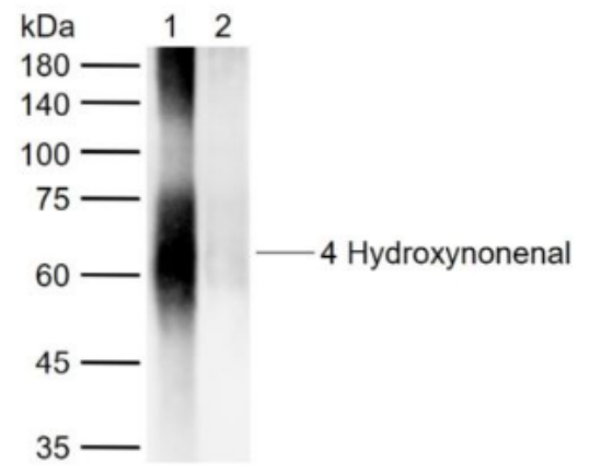 Anti-4 Hydroxynonenal antibody-4-羟基壬烯醛抗体,4 Hydroxynonenal