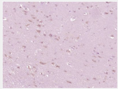 Anti-IL-10  antibody-白细胞介素-10抗体,IL-10