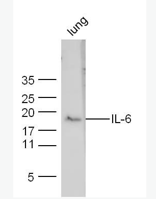 Anti-IL-6 antibody-白介素6抗體,IL-6