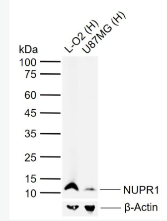 Anti-NUPR1 antibody-核蛋白p8抗體,NUPR1