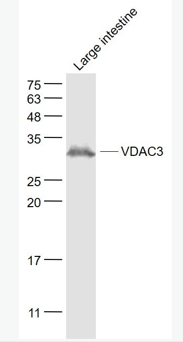 Anti-VDAC3  antibody-線粒體外膜孔蛋白3/電壓依賴陰離子通道蛋白3抗體,VDAC3