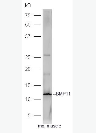 Anti-BMP11 antibody-骨形態(tài)發(fā)生蛋白11抗體,BMP11