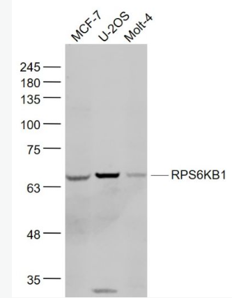 Anti-RPS6KB1 antibody-核糖体p70 S6蛋白激酶抗体,RPS6KB1