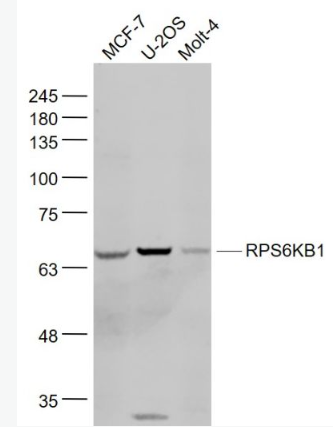 Anti-RPS6KB1 antibody-核糖體p70 S6蛋白激酶抗體,RPS6KB1