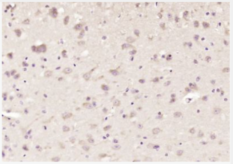 Anti-FOXO1 + FOXO3 + FOXO4 antibody-叉头蛋白O1/O3/O4抗体,FOXO1 + FOXO3 + FOXO4