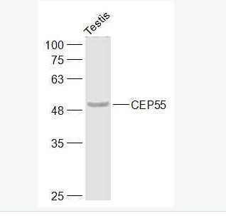 Anti-CEP55 antibody-中心體蛋白55kDa抗體,CEP55