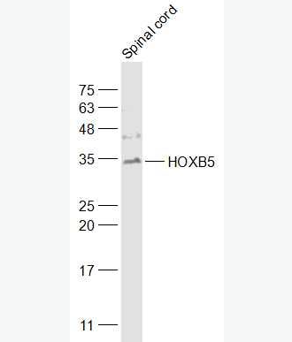 Anti-HOXB5 antibody-同源盒蛋白HOXB5抗体,HOXB5