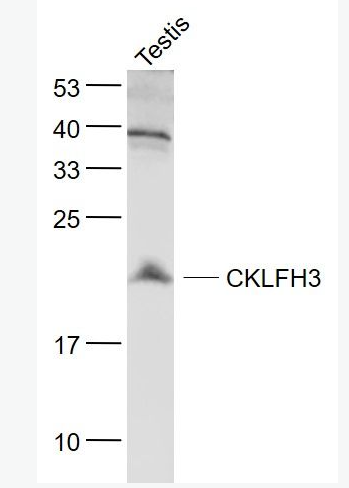 Anti-CKLFH3 antibody-趨化素樣因子超家族成員3抗體,CKLFH3