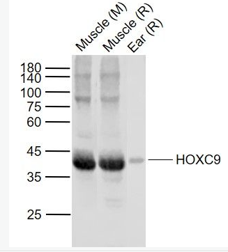 Anti-HOXC9 antibody-同源盒蛋白HOXC9抗體,HOXC9