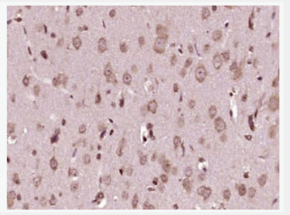 Anti-NEDD4 antibody-神經(jīng)前體細(xì)胞發(fā)育下調(diào)蛋白4抗體,NEDD4