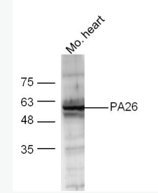 Anti-PA26 antibody-p53调控PA26核蛋白抗体,PA26