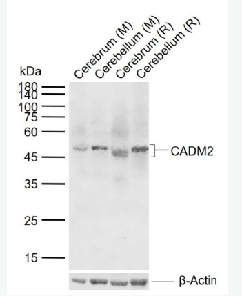 Anti-CADM2 antibody-细胞粘附分子2抗体,CADM2