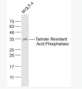 Anti-ACP5 antibody-抗酒石酸酸性磷酸酶5型/5型酸性磷酸酶抗体,ACP5
