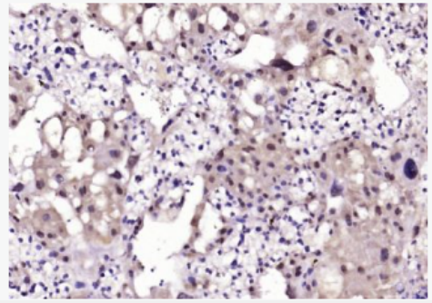 Anti-NFATC4 antibody-T细胞激活核转录因子4抗体,NFATC4