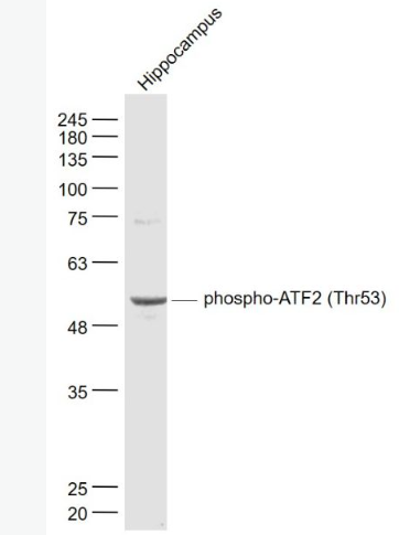 Anti-phospho-ATF2 (Thr53) antibody-磷酸化活化复制因子2抗体,phospho-ATF2 (Thr53)