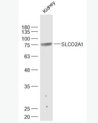 Anti-SLCO2A1 antibody-溶质载体蛋白家族21成员2抗体,SLCO2A1