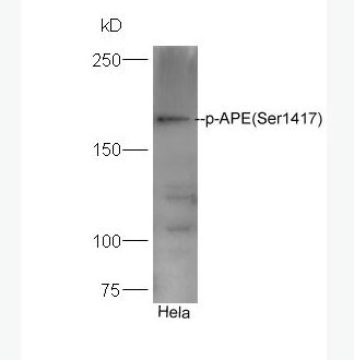 Anti-phospho-Girdin (Ser1417) antibody-磷酸化肌动蛋白结合蛋白Girdin抗体,phospho-Girdin (Ser1417)