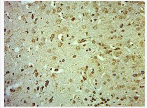 Anti-CLCN3 antibody-氯离子通道蛋白3抗体,CLCN3