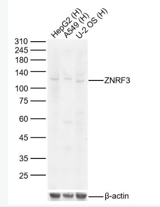 Anti-ZNRF3 antibody-锌指蛋白3/环指蛋白3抗体,ZNRF3