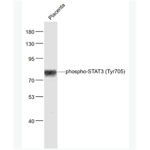 Anti-phospho-STAT3 (Tyr705)antibody-磷酸化信号转导和转录激活因子3抗体