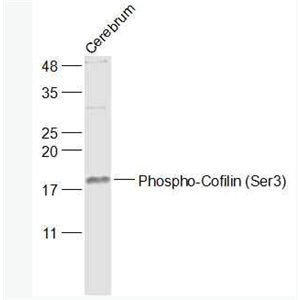 Anti-Phospho-Cofilin (Ser3) antibody-磷酸化丝切蛋白(Ser3)抗体