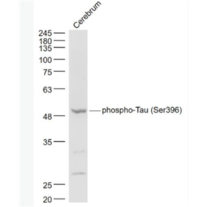 Anti-phospho-Tau (Ser396)  antibody-磷酸化微管相关蛋白抗体