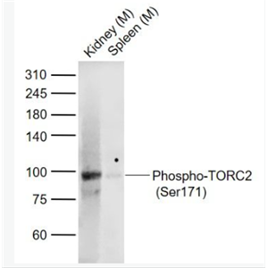 Anti-Phospho-TORC2 (Ser171)  antibody-磷酸化CREB转录共激活因子TORC2抗体