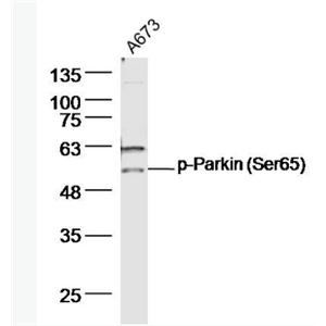 Anti-phospho-Parkin (Ser65)  antibody-磷酸化帕金森病蛋白2抗体,phospho-Parkin (Ser65)