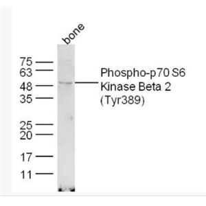 Anti-Phospho-p70 S6 Kinase Beta 2 (Tyr389) antibody-磷酸化核糖體S6蛋白激酶β2抗體