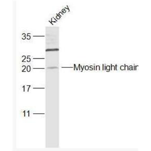 Anti-Myosin light chain (phospho S20) antibody-磷酸化肌球蛋白調節(jié)多肽9(平滑肌亞型)抗體