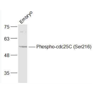 Anti-Phospho-cdc25C (Ser216) antibody-磷酸化细胞分裂周期蛋白25C抗体