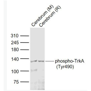 Anti-phospho-TrkA (Tyr490) antibody-磷酸化酪氨酸激酶A抗体