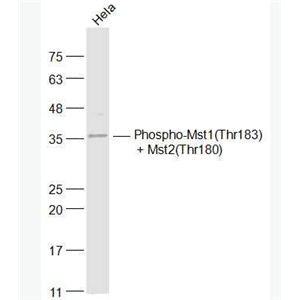 Anti-Phospho-Mst1(Thr183) + Mst2(Thr180) antibody-磷酸化蛋白激酶MST抗体