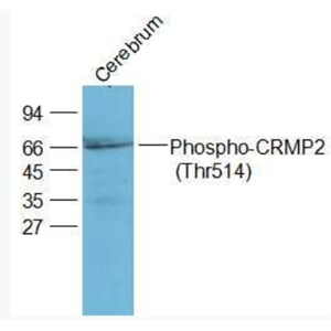 Anti-Phospho-CRMP2 (Thr514) antibody-磷酸化二氢嘧啶酶样2(CRMP2/DPYL2)抗体
