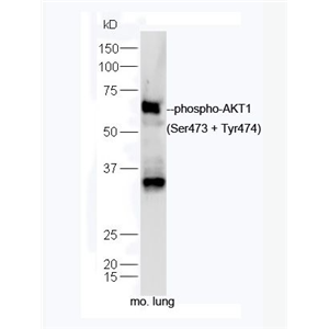 Anti-phospho-AKT1 (Ser473 + Tyr474) antibody-磷酸化蛋白激酶AKT1抗体