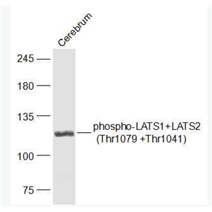 Anti-phospho-LATS1+LATS2 (Thr1079 +Thr1041) antibody-磷酸化肿瘤抑制基因LATS1/LATS2抗体