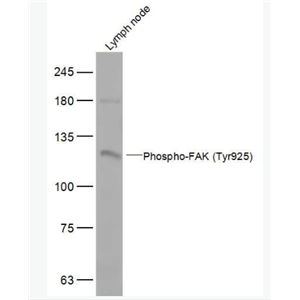 Anti-Phospho-FAK (Tyr925) antibody-磷酸化粘着斑激酶抗体
