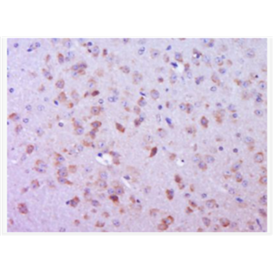 Anti-phospho-FAK (Ser732) antibody-磷酸化粘着斑激酶抗体