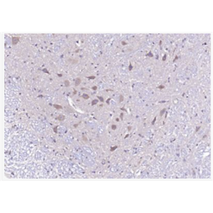 Anti-Phospho-CaMKII (Thr287) antibody-磷酸化钙/钙调素依赖蛋白激酶2α抗体