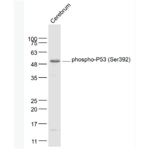 Anti-phospho-P53 (Ser392) antibody-磷酸化肿瘤抑制基因P53抗体