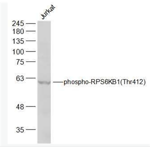 Anti-phospho-RPS6KB1 (Thr412) antibody-磷酸化核糖体S6蛋白激酶抗体