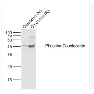 Anti-Phospho-Doublecortin (Ser47) antibody-磷酸化双皮质素抗体,Phospho-Doublecortin (Ser47)