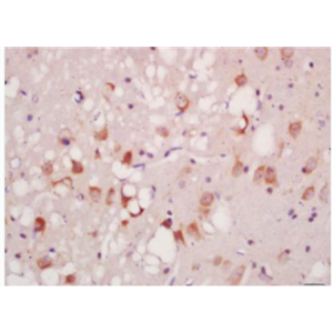 Anti-復(fù)Phospho-ATG1 (Ser556) antibody-磷酸化自噬相關(guān)蛋白1抗體