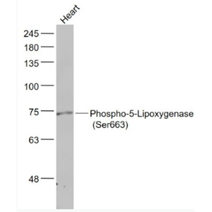 Anti-Phospho-ALOX5 (Ser663) antibody-磷酸化5-脂氧合酶抗体