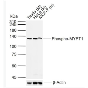 Anti-Phospho-MYPT1 (Thr696) antibody-磷酸化肌球蛋白磷酸酶抗体