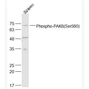 Anti-Phospho-PAK6 (Ser560) antibody-磷酸化p21激活激酶6抗体