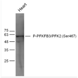 Anti-Phospho-PFKFB3/PFK2 (Ser467) antibody-磷酸化果糖-2,6-二磷酸酶3/磷酸果糖激酶2抗体