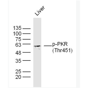 Anti-phoPhospho-PKR (Thr451)antibody-磷酸化干扰素诱导的双链RNA活化蛋白激酶抗体