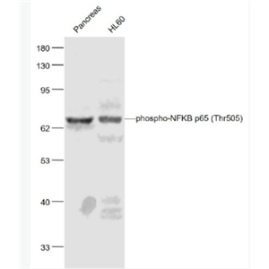 Anti-phospho-NFKB p65 (Thr505) antibody-磷酸化细胞核因子抗体