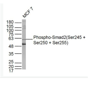 Anti-Phospho-Smad2 (Ser245 + Ser250 + Ser255) antibody-磷酸化细胞信号转导分子SMAD2抗体